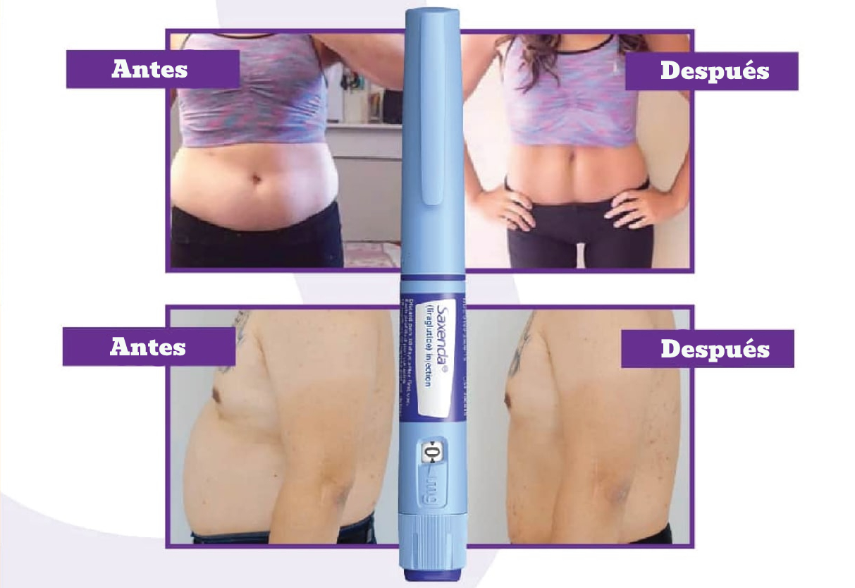 Saxenda Antes Y Despu s De La Terapia Efecto Rebote